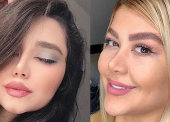 عمل بینی گوشتی و تغییرات ظاهری پس از آن